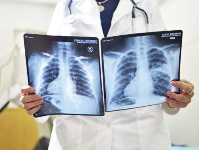 radiologia-en-salta
