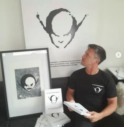 squillari los piojos