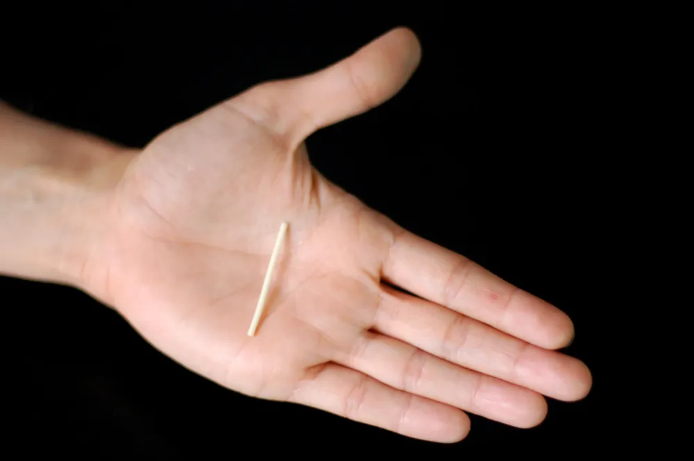 2021-10-05-implante-varilla