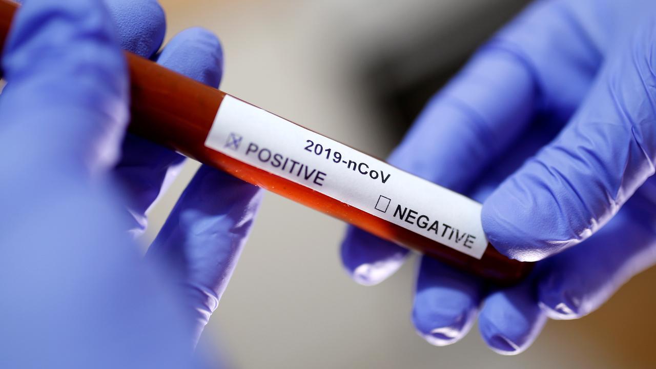 veertig-huisartsenpraktijken-testen-patienten-met-griepklachten-op-coronavirus