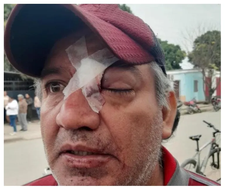 represión en hipólito yrigoyen