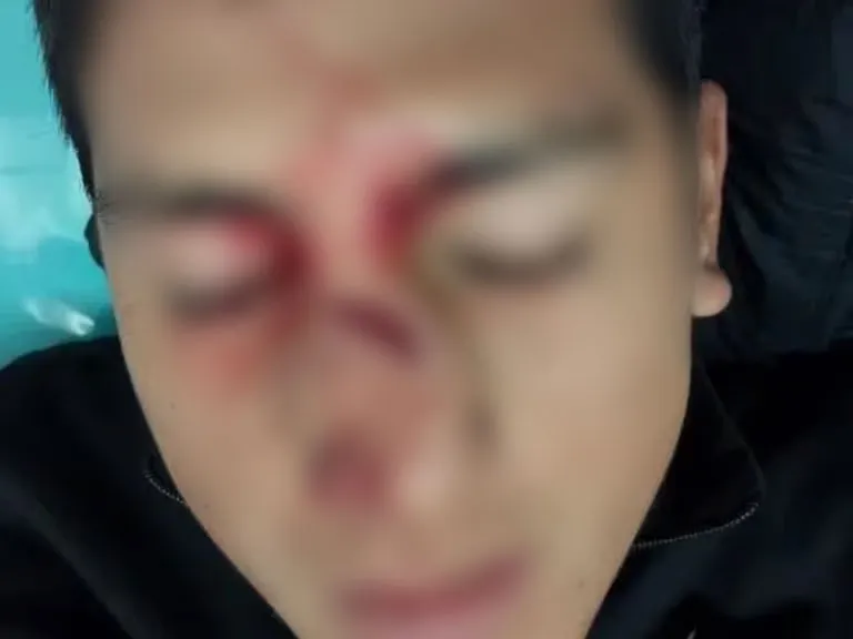 imagen-arbitro-lastimado-blur