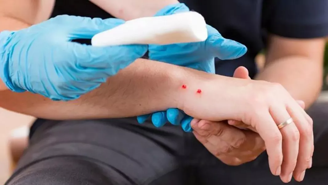 105523-salta-ya-registro-mas-de-70-casos-de-mordedura-de-vibora-20251218203030