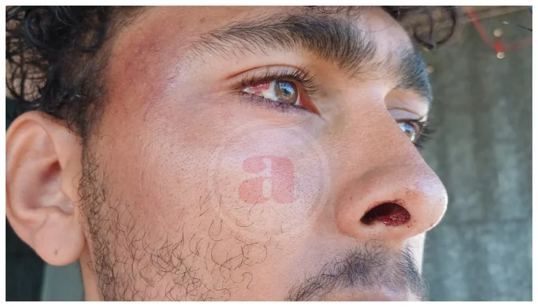 VIOLENCIA POLICIAL COLOMBIANOS (1)