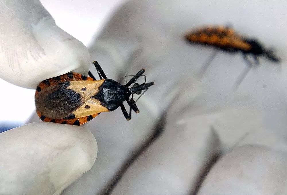 Chagas